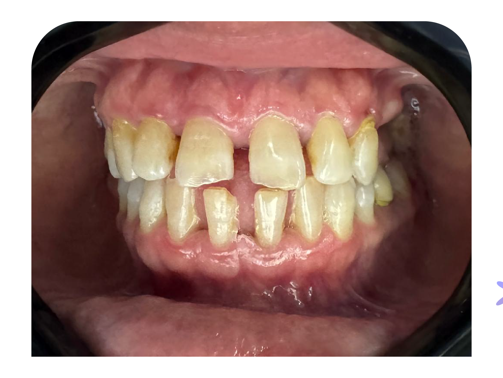 Después tratamiento